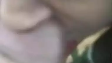 Must watch .. Ever had a Nose Job???